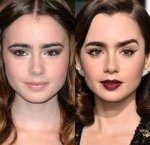 Actress Lily Collins Botox and Lip Filler with Her Before Ad After Photos