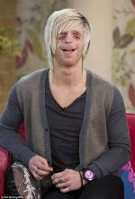 Courage and Resilience: Celebrities with Treacher Collins Syndrome