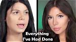 Did Blaire White Have Bottom Surgery? Unpacking the Truth