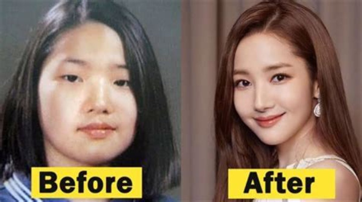 Did Yeonmi Park Undergo Plastic Surgery? Everything from Her Lies to Husband and Son
