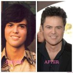 Donny Osmond's Plastic Surgery Journey Revealed