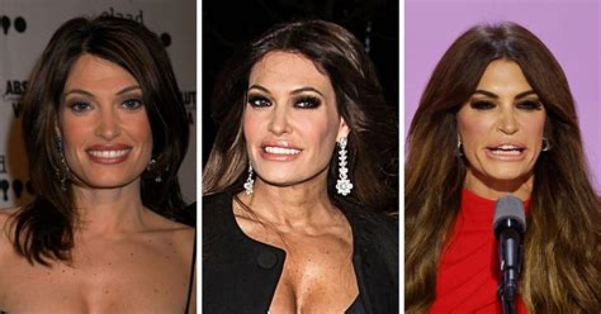 Dramatic Transformation: Guilfoyle Before and After