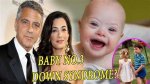 George Clooney's Children with Down Syndrome: a Story of Love and Acceptance