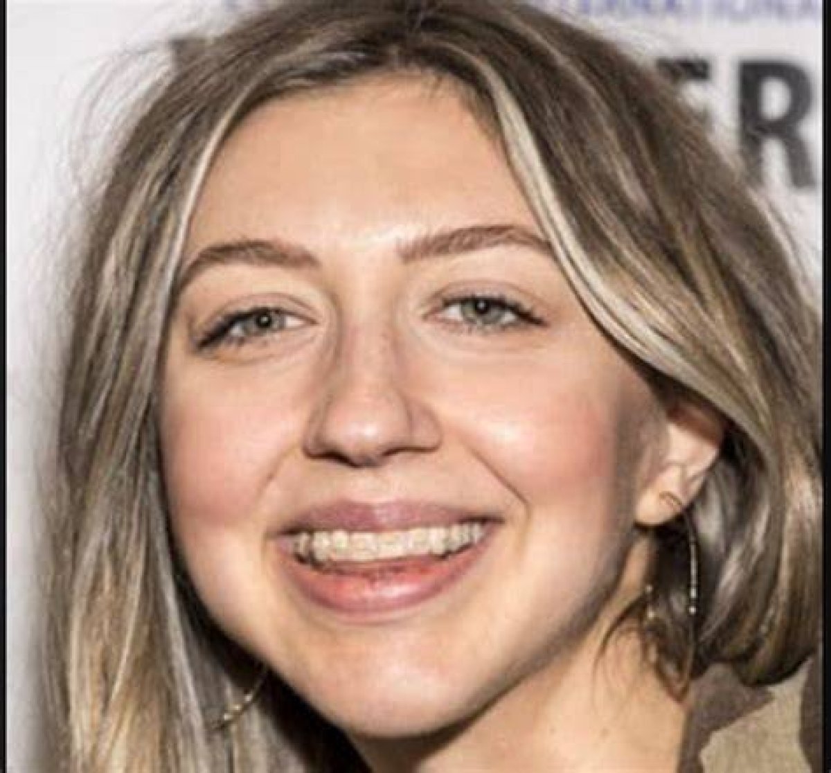 Heidi Gardner Teeth: a Comprehensive Look at Her Smile and Dental Journey