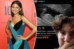 Is Zendaya Pregnant? the Truth Behind the Rumors