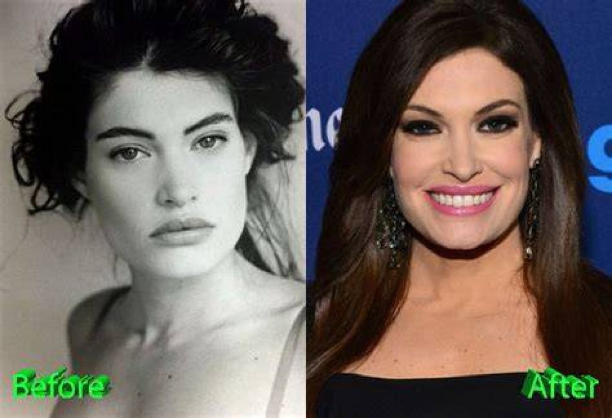 Kimberly Guilfoyle: a Journey of Transformation Before and After