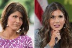 Kristi Noem Plastic Surgery: a Comprehensive Look