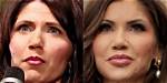 Kristi Noem's Transformation: Plastic Surgery Before and After