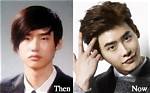 Lee Jong Suk | Before Plastic Surgery? Wrong with His Face? ·