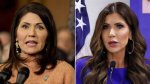 Meet Kristi Noem's Skilled Plastic Surgeon