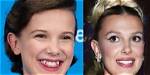 Nelly Furtado: Beauty, Evolution, and the Plastic Surgery Rumors