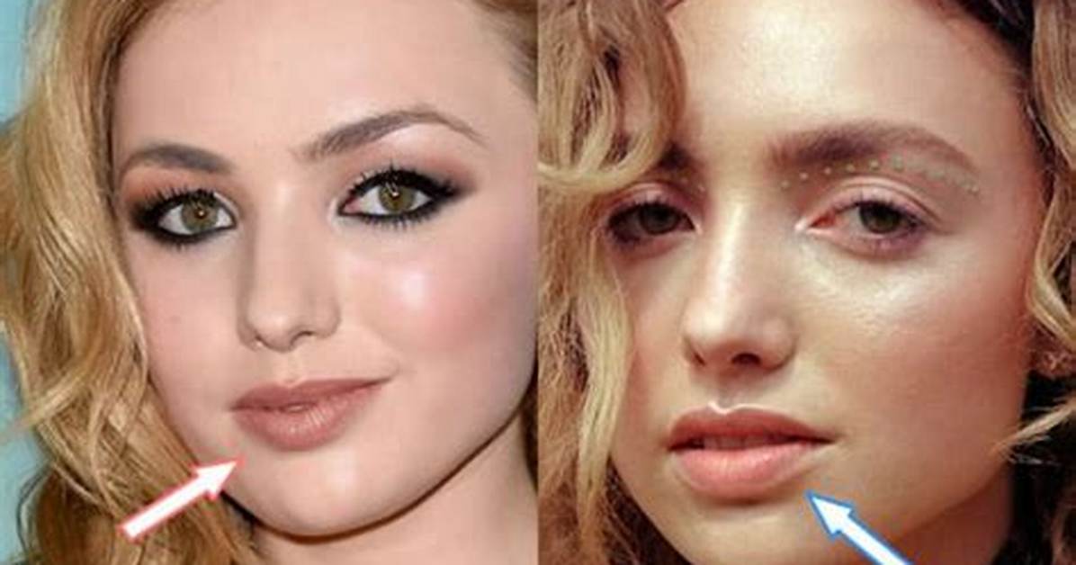 Peyton List's Plastic Surgery Journey Revealed