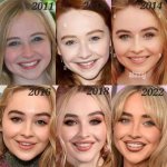 Savrina Carpenter's Nose Job: a Transformation Journey