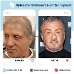 Sylvester Stallone's Iconic Hair: a Look at His Legendary Styles