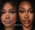 Sza Nose Job 2025: the Ultimate Guide to Her Transformation