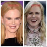 The Truth About Nicole Kidman's Plastic Surgery: Uncovering the Facts