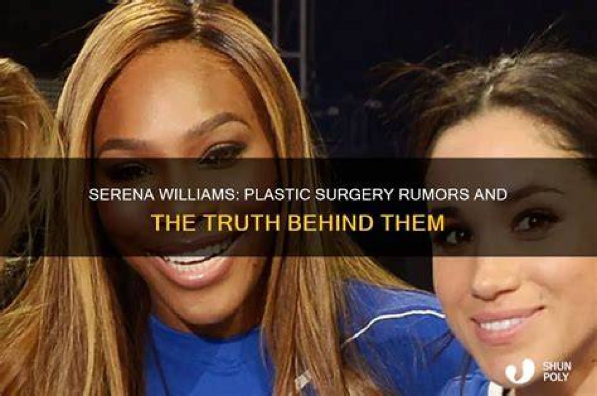 The Truth Behind the Plastic Surgery Rumors