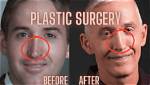 Trey Gowdy Nose Surgery: Understanding the Impact and Changes