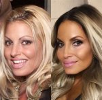 Trish Stratus Plastic Surgery: Before and After Photos