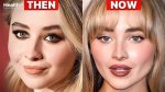 Unraveling Sabrina Carpenter's Plastic Surgery Whispers