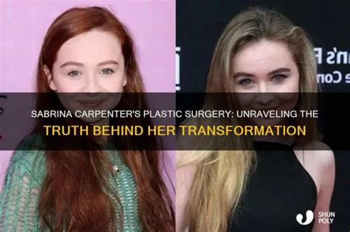 Unraveling the Mystery: Has Sabrina Had Plastic Surgery?