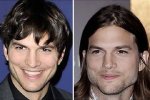 Unveiling Ashton Kutcher's Plastic Surgery Journey: Truths Revealed