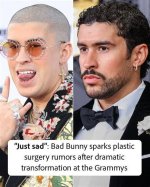 Unveiling Bad Bunny's Plastic Surgery Journey: Revealing the Truth