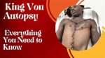Unveiling the Mystery: King Von Autopsy Pic and Its Impact