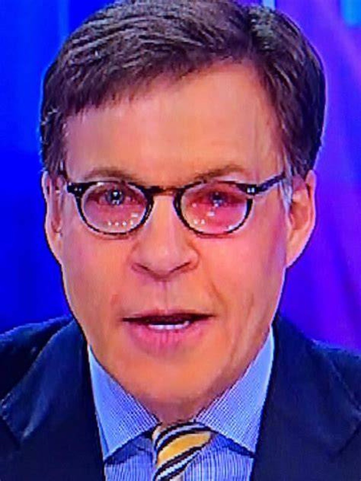 Unveiling the Secrets of Bob Costas' Eye: Discoveries and Insights