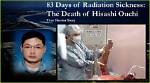 Unveiling the Tragic Tale of Hisashi Ouchi: Real Photos from 1999