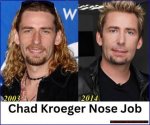 Unveiling the Truth: Did Chad Kroeger Have a Nose Job?