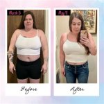 Wegovy Before and After: Transformations, Benefits, and Insights