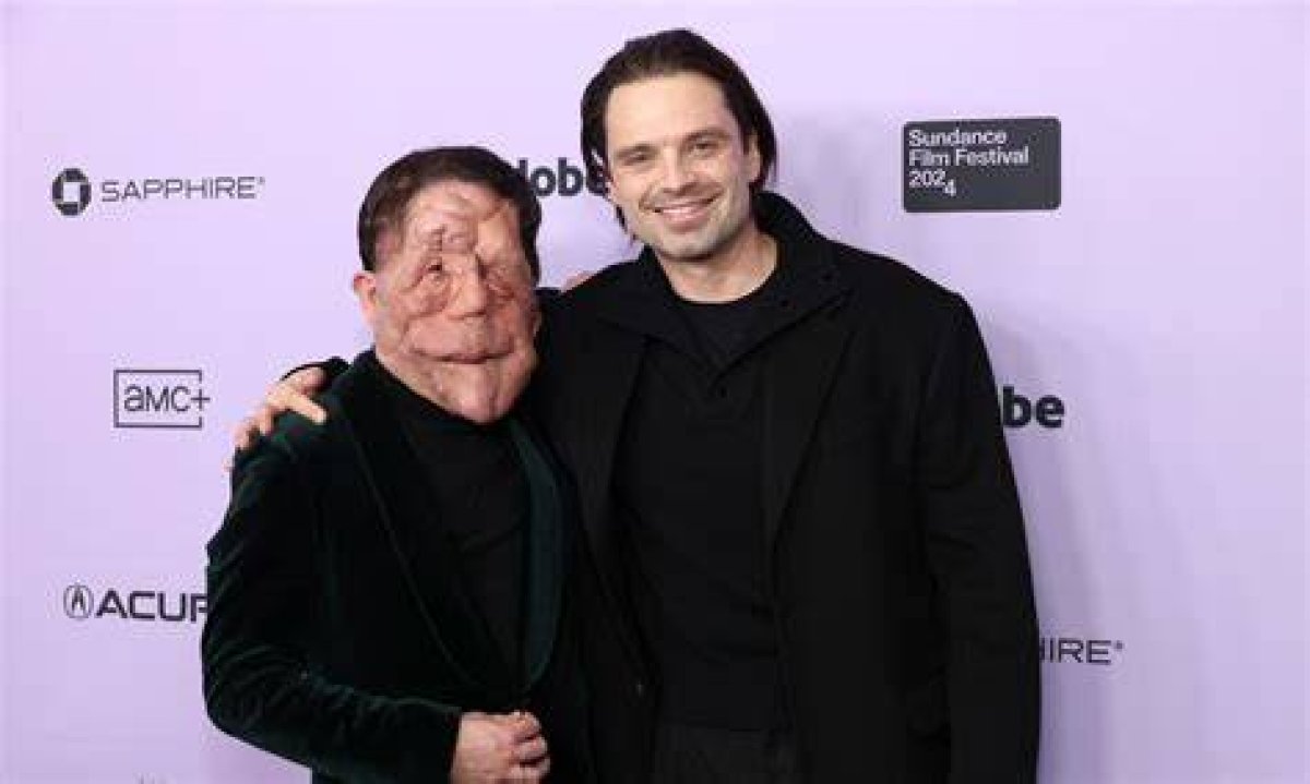 Who Is Adam Pearson's Girlfriend? a Deep Dive into His Relationship