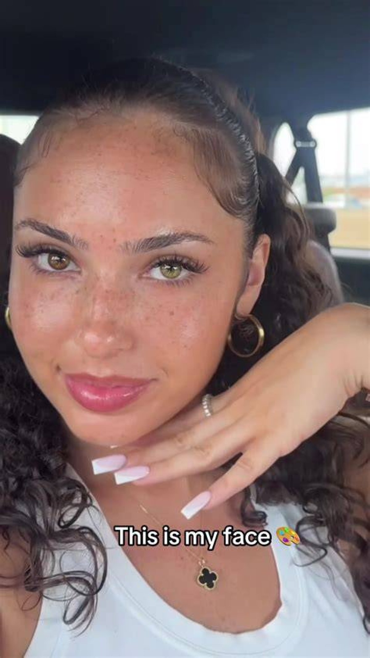 Who Is Tiktok’s @Ashaley. Nucole? Images of Ash Kaash Before Surgery